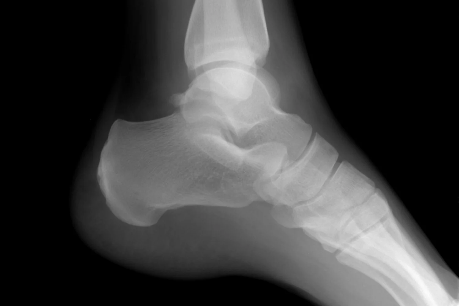 Indraaien en achterwaarts lopen