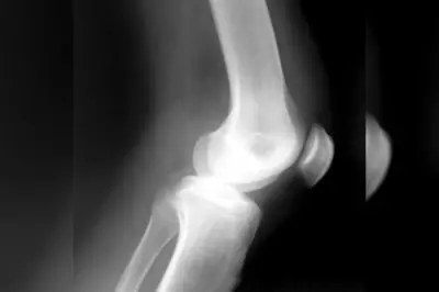 Geen Czech International voor Erik Meijs